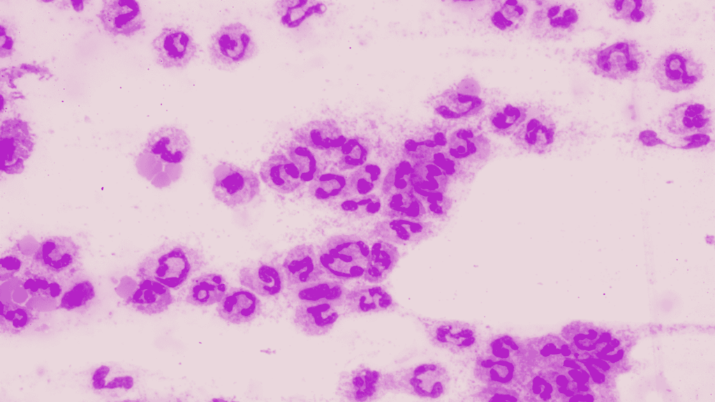 sepsis under microscope